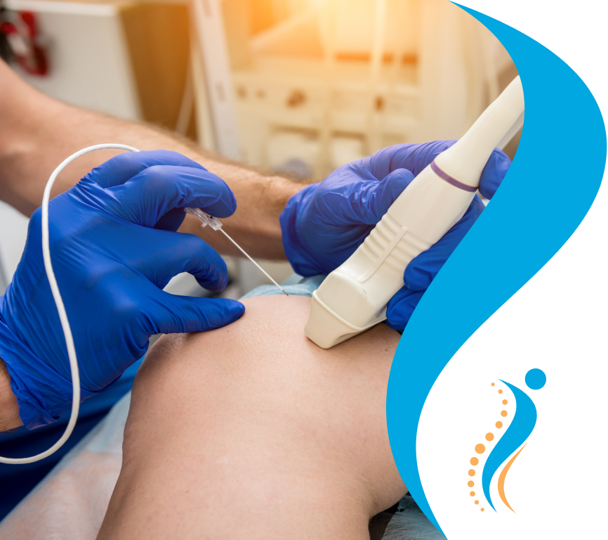 Radiofrequency ablation at Altus: is a minimally invasive, out-patient procedure, in which places specialized needles over the affected nerves and then sends thermal energy or heat signals through the needles.