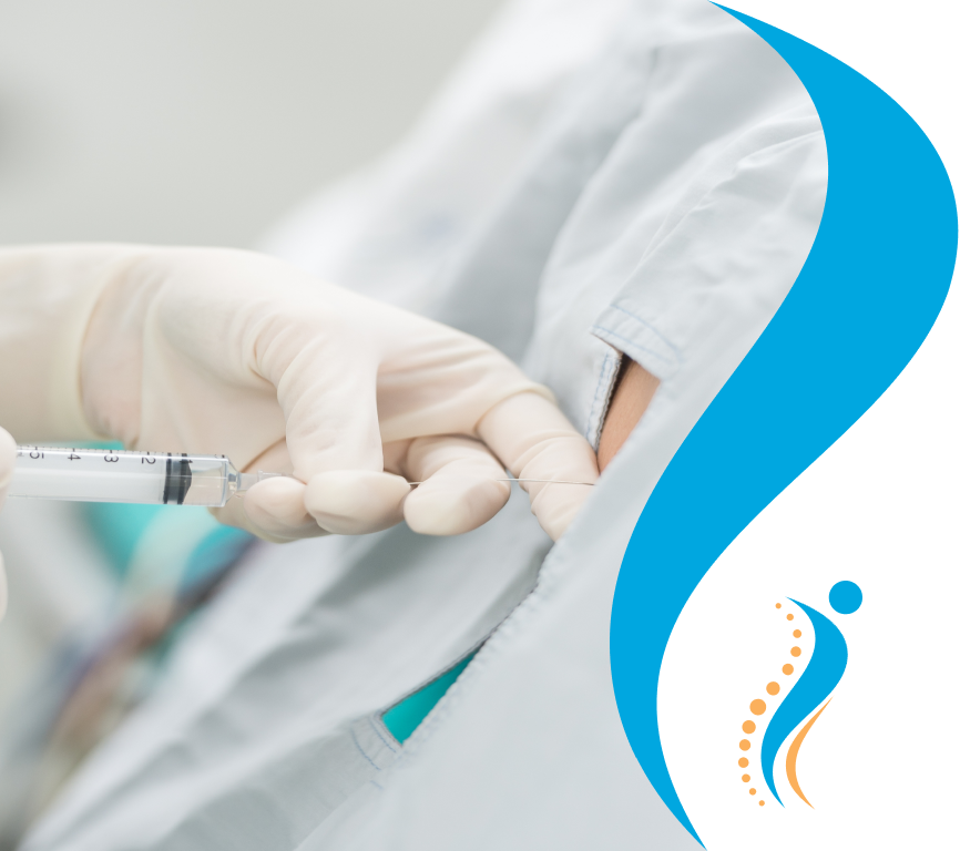 Epidural Steroid Injection: minimally invasive procedure that involves your provider inserting a needle into the spinal canal, called the epidural space, to provide pain relief.