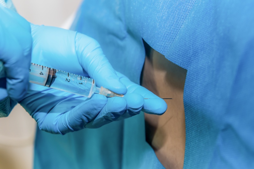 Anesthetic injection,Anesthesiologist or doctor prepping area where her is going to do a Epidural nerve or spinal block for a patient who is about to have a give birth per vaginal or cesarean section.