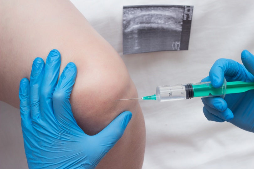 A doctor injects a medical injection of chondroprotector and hyaluronic acid into the knee of a woman to restore the knee joint, cartilage and synovial fluid, close-up